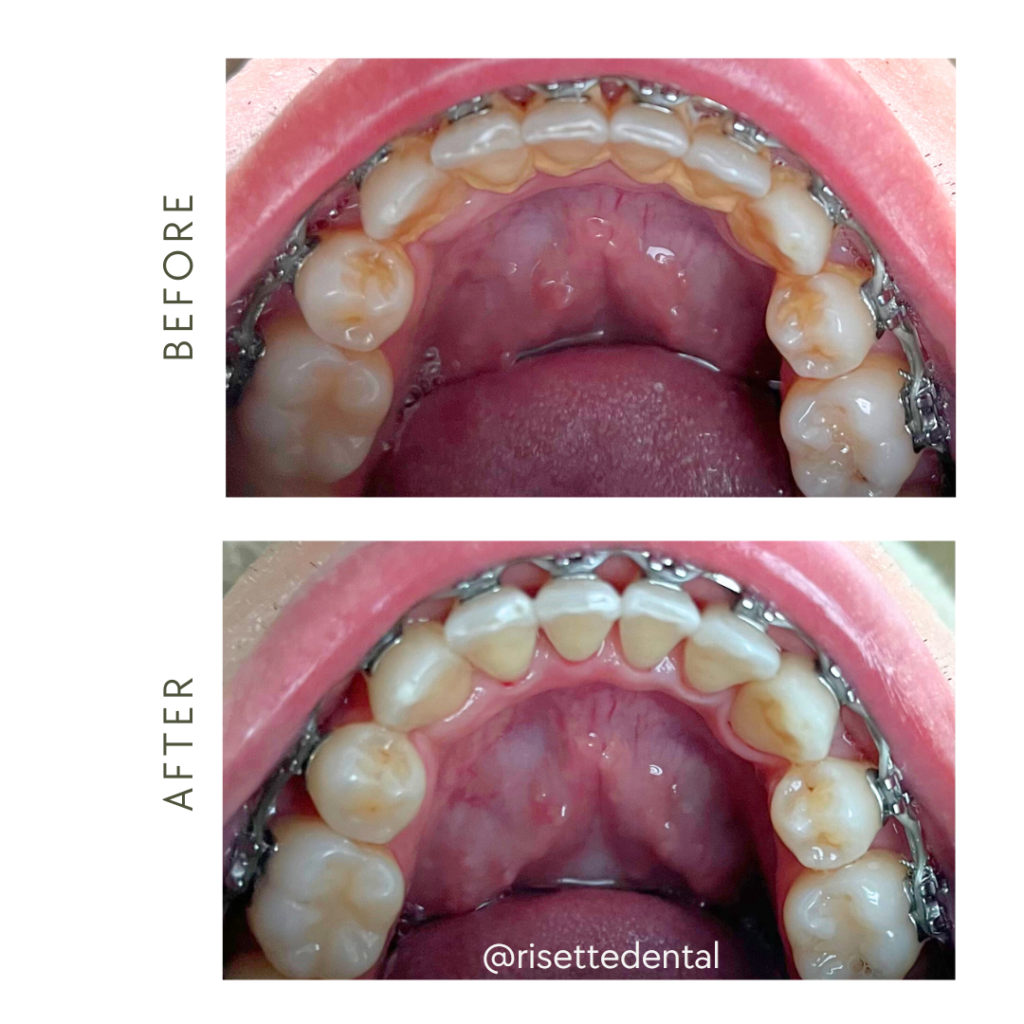 Ortho/Braces management